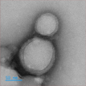 ICG@PLGA @Liposome 100nm