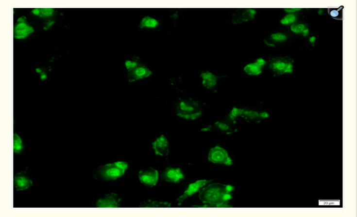 ENT-loaded and FITC-labelled LyP-1-PEG-PEI-g-CHT nanoparticles