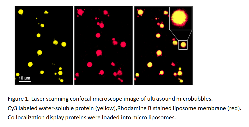 Ultrasonic microbubble lipid material