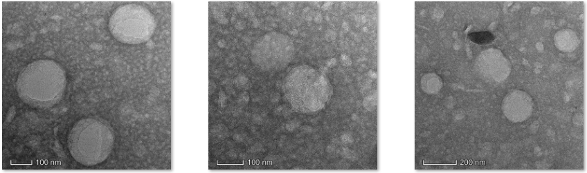 Liposome@Erianin and CY5,±100nm 